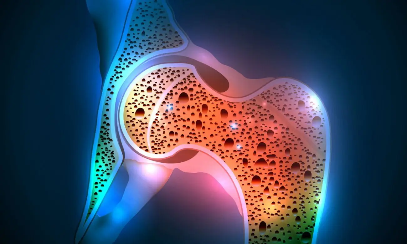Non sottovalutare l’osteoporosi: ecco perché è una delle malattie più gravi e silenziose