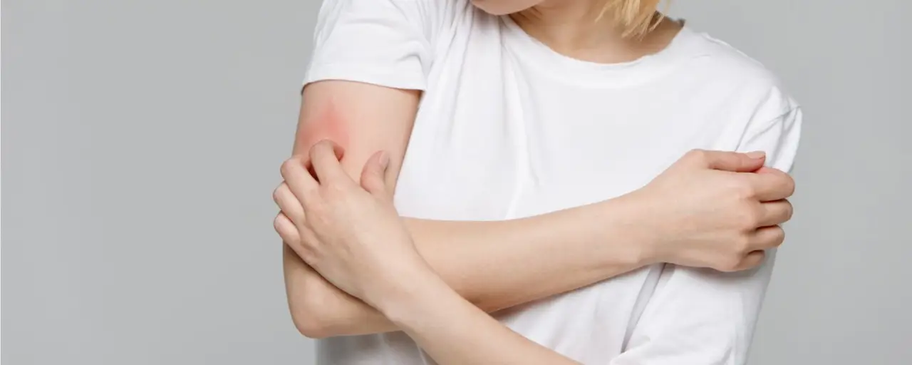 Dermatite intima maschile: cause comuni e come curarla immediatamente